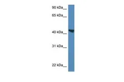 Anti-MEIS3 antibody, C-term used in Western Blot (WB). GTX49099