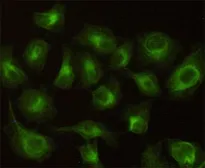 Anti-CBR1 antibody [2C9-B12-C4] used in Immunocytochemistry/ Immunofluorescence (ICC/IF). GTX49137