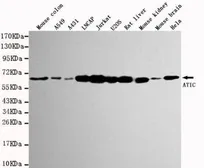 Anti-ATIC antibody [3H12-C9-H9] used in Western Blot (WB). GTX49205