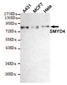 Anti-SMYD4 antibody [7C8-B11-F10] used in Western Blot (WB). GTX49257