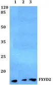 Anti-FXYD2 antibody used in Western Blot (WB). GTX49356