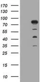 Anti-MTMR2 antibody [1F10] used in Western Blot (WB). GTX49357