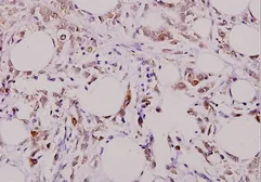 Anti-Caspase 3 p17 subunit antibody used in IHC (Paraffin sections) (IHC-P). GTX49360