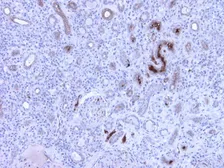 Anti-C4C antibody [99-72-18] used in Immunohistochemistry (IHC). GTX49368