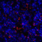 Anti-TIM-3 antibody used in IHC (Paraffin sections) (IHC-P). GTX49381