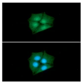 Anti-CRABP1 antibody [AT1A1] used in Immunocytochemistry/ Immunofluorescence (ICC/IF). GTX50013