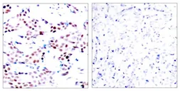 Anti-c-Jun (phospho Thr91) antibody used in IHC (Paraffin sections) (IHC-P). GTX50100