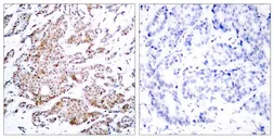 Anti-c-Myc (phospho Thr58) antibody used in IHC (Paraffin sections) (IHC-P). GTX50111
