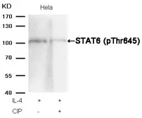 Anti-STAT6 (phospho Thr645) antibody used in Western Blot (WB). GTX50125