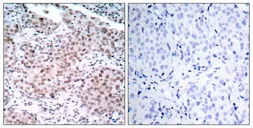 Anti-Estrogen Receptor alpha (phospho Ser104) antibody used in IHC (Paraffin sections) (IHC-P). GTX50137