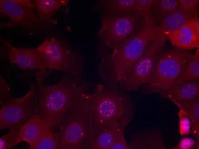 Anti-Estrogen Receptor alpha (phospho Ser167) antibody used in Immunocytochemistry/ Immunofluorescence (ICC/IF). GTX50140