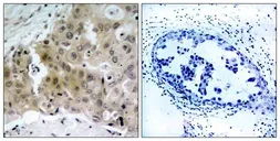 Anti-VEGF Receptor 2 (phospho Tyr1175) antibody used in IHC (Paraffin sections) (IHC-P). GTX50151