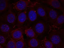 Anti-IGF1R beta (phospho Tyr1135 / Tyr1136) / Insulin Receptor beta (phospho Tyr1150 / Tyr1151) antibody used in Immunocytochemistry/ Immunofluorescence (ICC/IF). GTX50154