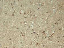 Anti-Tau (phospho Ser396) antibody used in IHC (Paraffin sections) (IHC-P). GTX50166