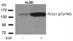 Anti-PLCG1 (phospho Tyr783) antibody used in Western Blot (WB). GTX50167