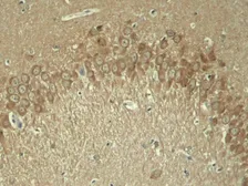 Anti-Tau (phospho Thr181) antibody used in IHC (Paraffin sections) (IHC-P). GTX50171