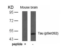 Anti-Tau (phospho Ser262) antibody used in Western Blot (WB). GTX50175