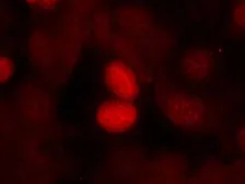 Anti-FOXO1 (phospho Ser256) antibody used in Immunocytochemistry/ Immunofluorescence (ICC/IF). GTX50179