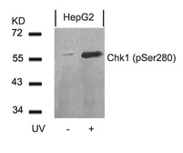 Anti-Chk1 (phospho Ser280) antibody used in Western Blot (WB). GTX50200