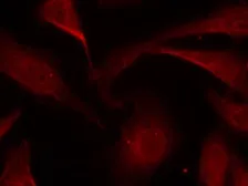 Anti-NFkB p65 (phospho Ser529) antibody used in Immunocytochemistry/ Immunofluorescence (ICC/IF). GTX50254