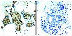 Anti-p38 MAPK (phospho Tyr182) antibody used in IHC (Paraffin sections) (IHC-P). GTX50281