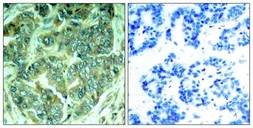 Anti-p62Dok (phospho Tyr398) antibody used in IHC (Paraffin sections) (IHC-P). GTX50298