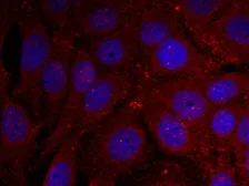 Anti-alpha Synuclein (phospho Tyr136) antibody used in Immunocytochemistry/ Immunofluorescence (ICC/IF). GTX50306
