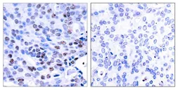 Anti-NFkB p105/p50 antibody used in IHC (Paraffin sections) (IHC-P). GTX50377