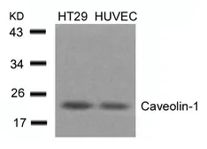 Anti-Caveolin 1 antibody used in Western Blot (WB). GTX50462