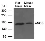 Anti-nNOS antibody used in Western Blot (WB). GTX50497