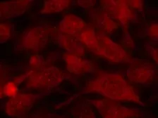 Anti-Stathmin 1 antibody used in Immunocytochemistry/ Immunofluorescence (ICC/IF). GTX50545