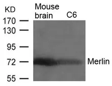 Anti-Merlin antibody used in Western Blot (WB). GTX50579