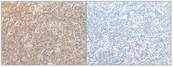 Anti-eIF2 alpha antibody used in IHC (Paraffin sections) (IHC-P). GTX50590