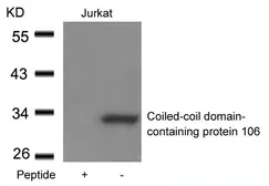 Anti-CCDC106 antibody used in Western Blot (WB). GTX50641