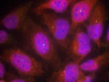 Anti-Cyclin B1 antibody used in Immunocytochemistry/ Immunofluorescence (ICC/IF). GTX50663