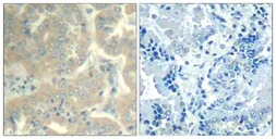 Anti-FAK antibody used in IHC (Paraffin sections) (IHC-P). GTX50666