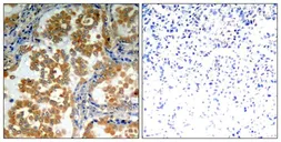 Anti-PKC zeta antibody used in IHC (Paraffin sections) (IHC-P). GTX50684