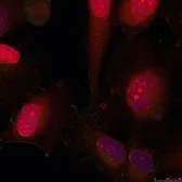 Anti-STAT3 antibody used in Immunocytochemistry/ Immunofluorescence (ICC/IF). GTX50709