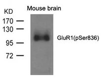 Anti-GluR1 (phospho Ser818) antibody used in Western Blot (WB). GTX50729