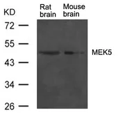 Anti-MEK5 antibody used in Western Blot (WB). GTX50752
