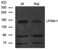 Anti-Integrin alpha 4 antibody used in Western Blot (WB). GTX50786