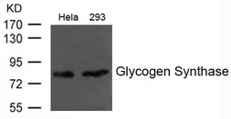 Anti-Glycogen Synthase antibody used in Western Blot (WB). GTX50798