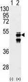 Anti-PPM1F antibody, N-term used in Western Blot (WB). GTX50878
