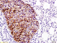 Anti-Emp1 antibody used in IHC (Paraffin sections) (IHC-P). GTX50979