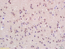 Anti-ASH1L antibody used in IHC (Paraffin sections) (IHC-P). GTX51191