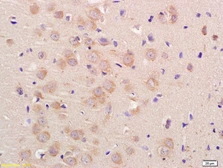 Anti-UNC80 antibody used in IHC (Paraffin sections) (IHC-P). GTX51241