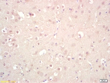 Anti-GGNBP2 antibody used in IHC (Paraffin sections) (IHC-P). GTX51277
