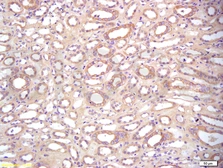 Anti-BAMBI antibody used in IHC (Paraffin sections) (IHC-P). GTX51308