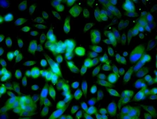 Anti-Ubiquitin antibody used in Immunocytochemistry/ Immunofluorescence (ICC/IF). GTX51517