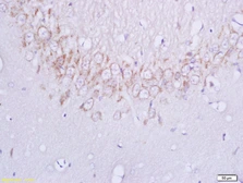 Anti-Plexin B1 antibody used in IHC (Paraffin sections) (IHC-P). GTX51549